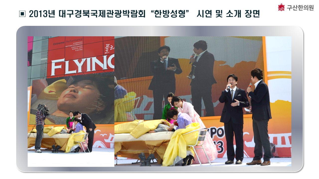 2013년 대구경북국제관광박람회 한방성형 매선리프팅 시연 및 소개